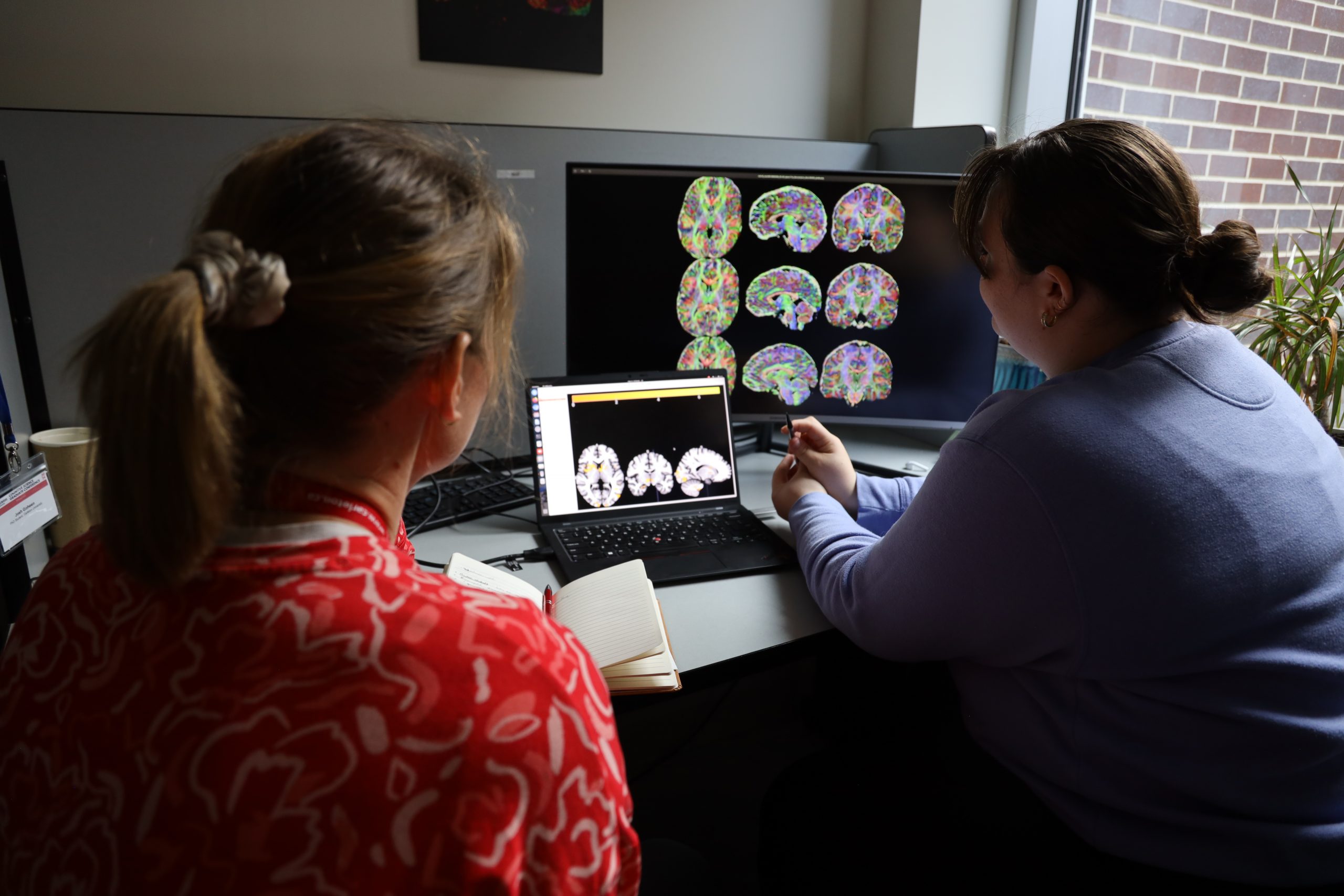 Two women observe a laptop with brain images on it