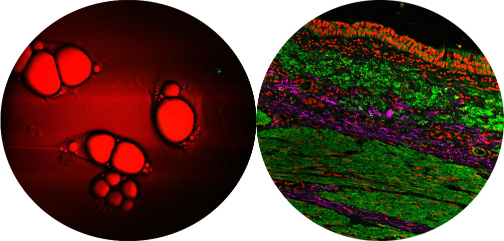 Carleton Researchers Collaborate to Improve How Diseases are Diagnosed and Treated