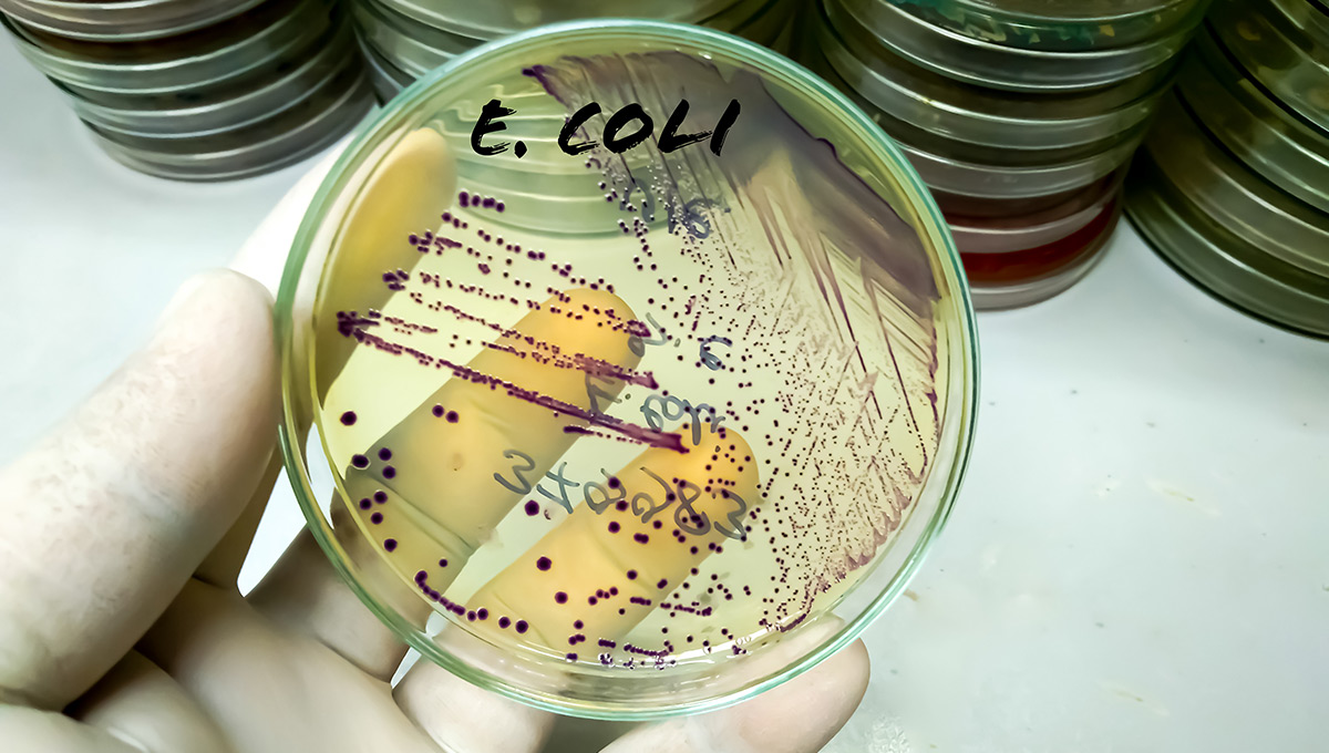 A hand holding a petri dish with Escherichia coli bacteria