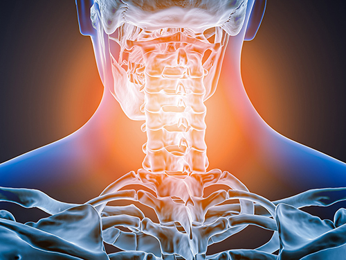 A design concept depicting chronic pain in a spinal column with inflammation